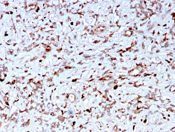 IHC staining of FFPE human liver with C1QA antibody. HIER: boil tissue sections in pH 9 10mM Tris with 1mM EDTA for 10-20 min and allow to cool before testing.