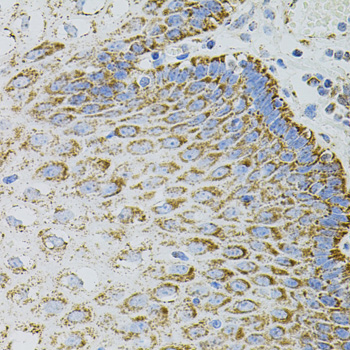 Anti-EPO Antibody