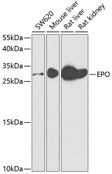 Anti-EPO Antibody