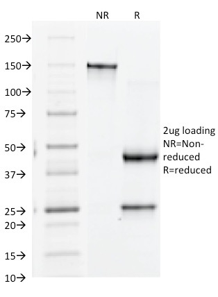 Anti-Integrin beta 3 Antibody [Y2/51]