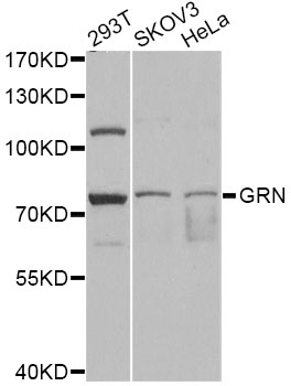 Anti-GRN Antibody