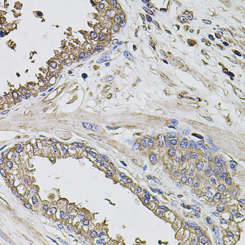 Anti-GRN Antibody