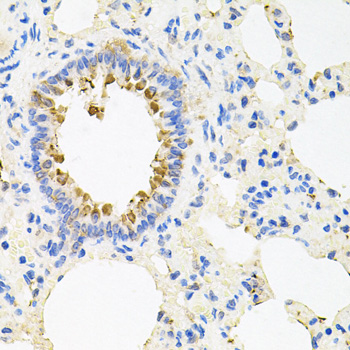 Anti-NCR3 Antibody