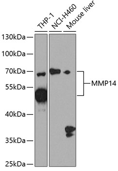 Anti-MMP14 Antibody