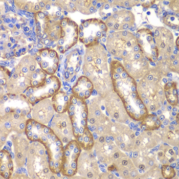 Anti-MMP14 Antibody
