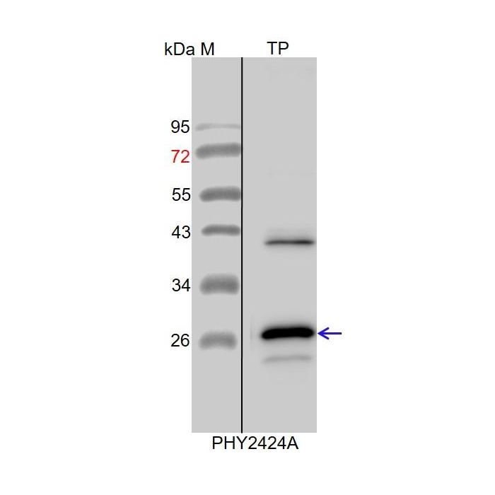 APX3 / Anti-L-Ascorbate Peroxidase 3 Antibody