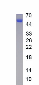Figure. SDS-PAGE