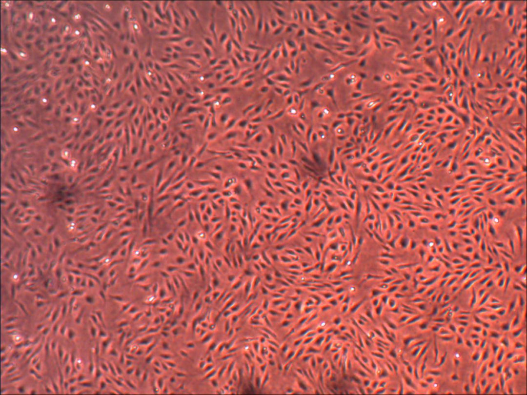 Primary Human Umbilical Venous Endothelial Cells