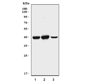 Western blot testing of human 1) HeLa, 2) HaCaT and 3) Caco-2 cell lysate with MASPIN antibody. Predicted molecular weight: 42~45 kDa.