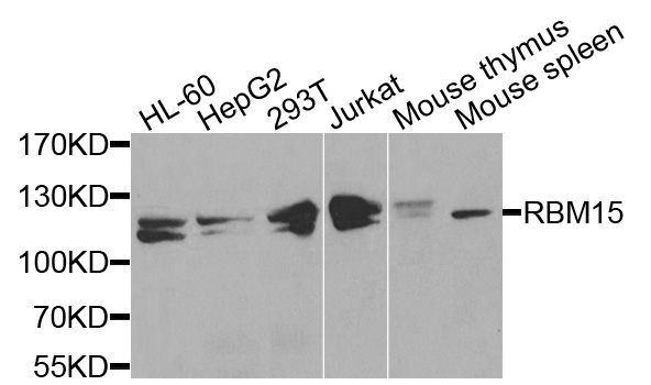 Anti-RBM15 Antibody