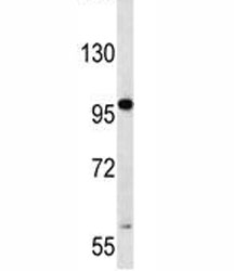 RNF43 antibody western blot analysis in CEM lysate.