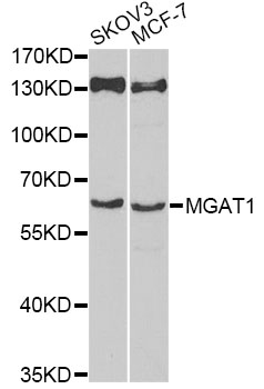 Anti-MGAT1 Antibody