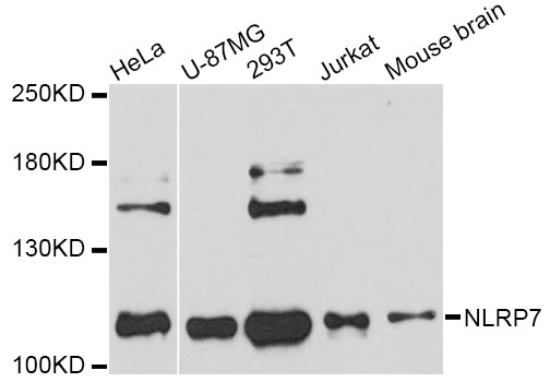 Anti-NLRP7 Antibody