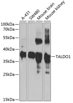 Anti-TALDO1 Antibody