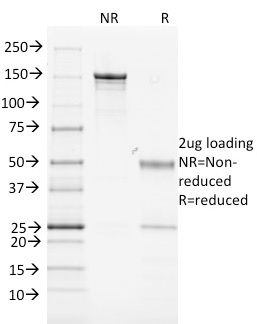 Anti-MHC Class II Antibody [MK-D6]