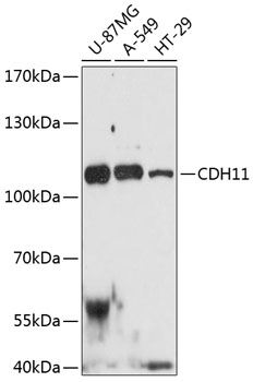 Anti-CDH11 Antibody