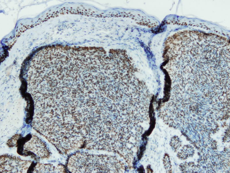 Anti-p63 Antibody [I27-I]