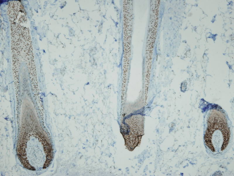 Anti-p63 Antibody [I27-I]