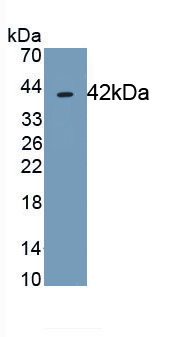 Western Blot; Sample: Recombinant TSPAN30, Human.