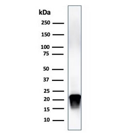 Western blot testing of human brain lysate with Myelin Basic Protein antibody (clone MBP/4276). Isoforms may be visualized from 20~37 kDa.