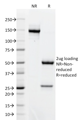 Anti-AKT1 Antibody [AKT1/2491]