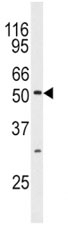 Western blot analysis of JNK3 antibody and mouse brain tissue lysate.