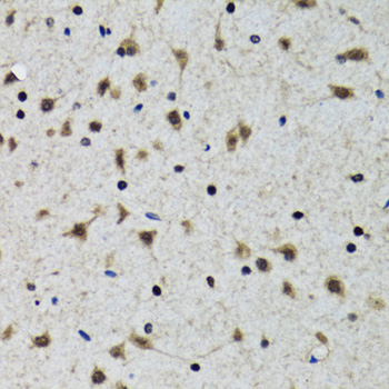 Anti-SLC23A2 Antibody