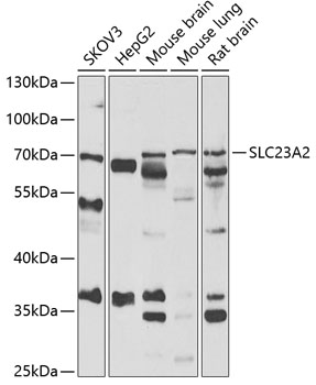 Anti-SLC23A2 Antibody