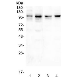 Western blot testing of 1) rat skeletal muscle, 2) rat heart, 3) human HeLa, 4) human A549 and 5) human 293 lysate with PSD95 antibody. Predicted molecular weight ~80 kDa but routinely observed at 90~95 kDa.