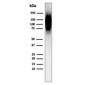 Western blot testing of human spleen lysate with HIF1 alpha antibody (clone Ha111a).