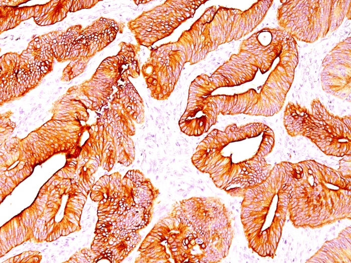 Anti-pan Cytokeratin Antibody [C11] - BSA and Azide free