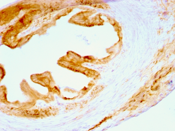 Anti-pan Cytokeratin Antibody [C11] - BSA and Azide free