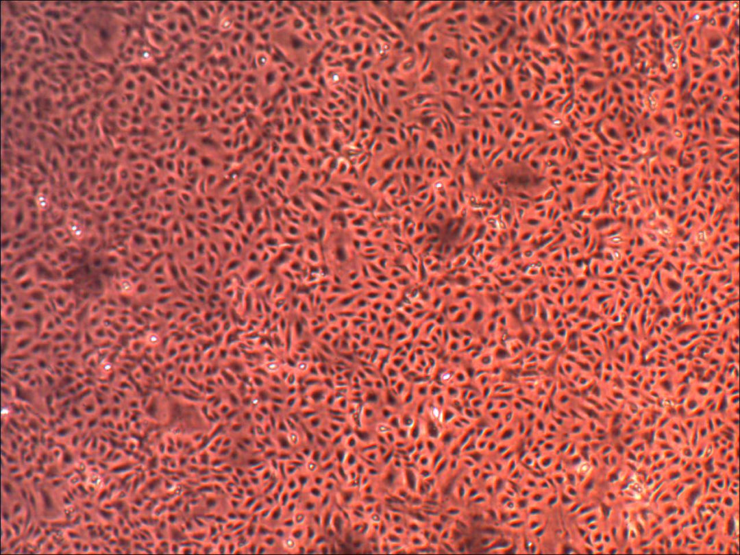 Primary Human Lung Microvascular Endothelial Cells