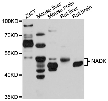 Anti-NADK Antibody