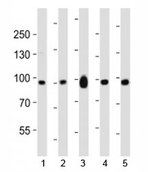 Western blot analysis of lysate from mouse 1) NIH3T3 cell line, 2) brain, 3) heart, 4) pancreas and 5) rat brain tissue lysate using Ephb1 antibody at 1:1000.