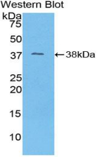 Western Blot; Sample: Recombinant protein.