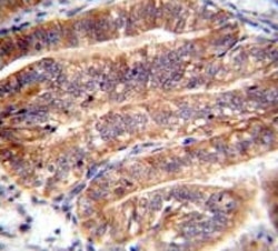 NUMB antibody immunohistochemistry analysis in formalin fixed and paraffin embedded human uterus tissue.