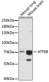 Anti-ATF6B Antibody