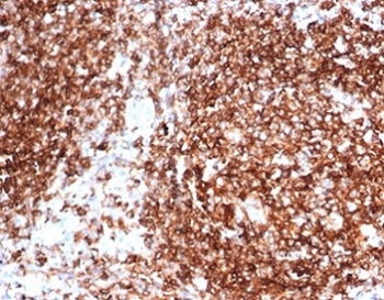 IHC staining of FFPE human tonsil tissue with Pan-HLA antibody (clone HLA-Pan/6663). HIER: boil tissue sections in pH 9 10mM Tris with 1mM EDTA for 20 min and allow to cool before testing.