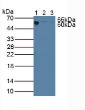 Western Blot; Sample: Lane1: Porcine Serum ; Lane2: Porcine Liver Tissue; Lane3: Porcine Spleen Tissue.