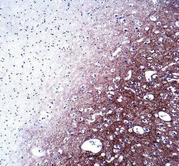 IHC testing of FFPE human brain tissue with Synaptophysin antibody. HIER: steam section in pH6 citrate buffer for 20 min and allow to cool prior to staining.