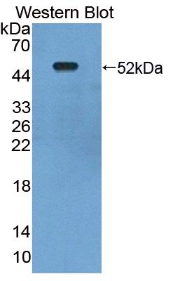 Western Blot; Sample: Recombinant protein.