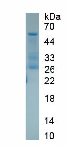 Figure. SDS-PAGE