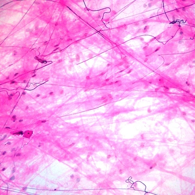 Mammal Areolar Tissue Slide, Spread, Verhoeffs Stain