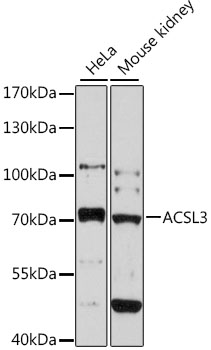 Anti-ACSL3 Antibody