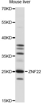 Anti-ZNF22 Antibody