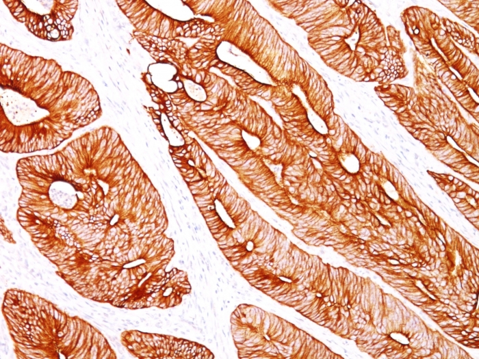 Anti-Cytokeratin 8 Antibody [K8/383]
