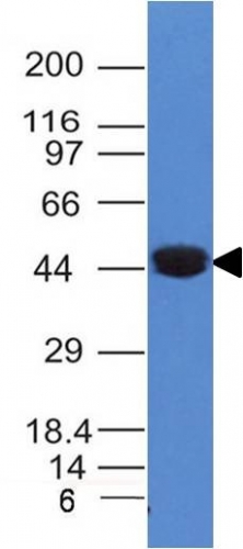 Anti-Cytokeratin 8 Antibody [K8/383]