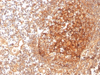 IHC staining of FFPE human tonsil with GCLM antibody. HIER: boil tissue sections in pH 9 10mM Tris with 1mM EDTA for 20 min and allow to cool before testing.