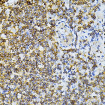Anti-ND5 Antibody